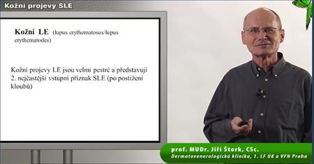 http://www.lupus-portal.cz/index.php?pg=videa--kozni-projevy-sle